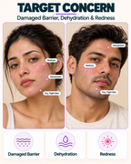 Epiderm-Reboot 72H™