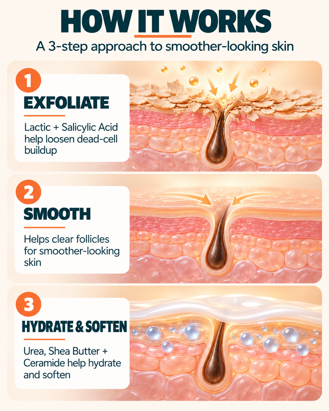 Kerato-Refining Lotion™