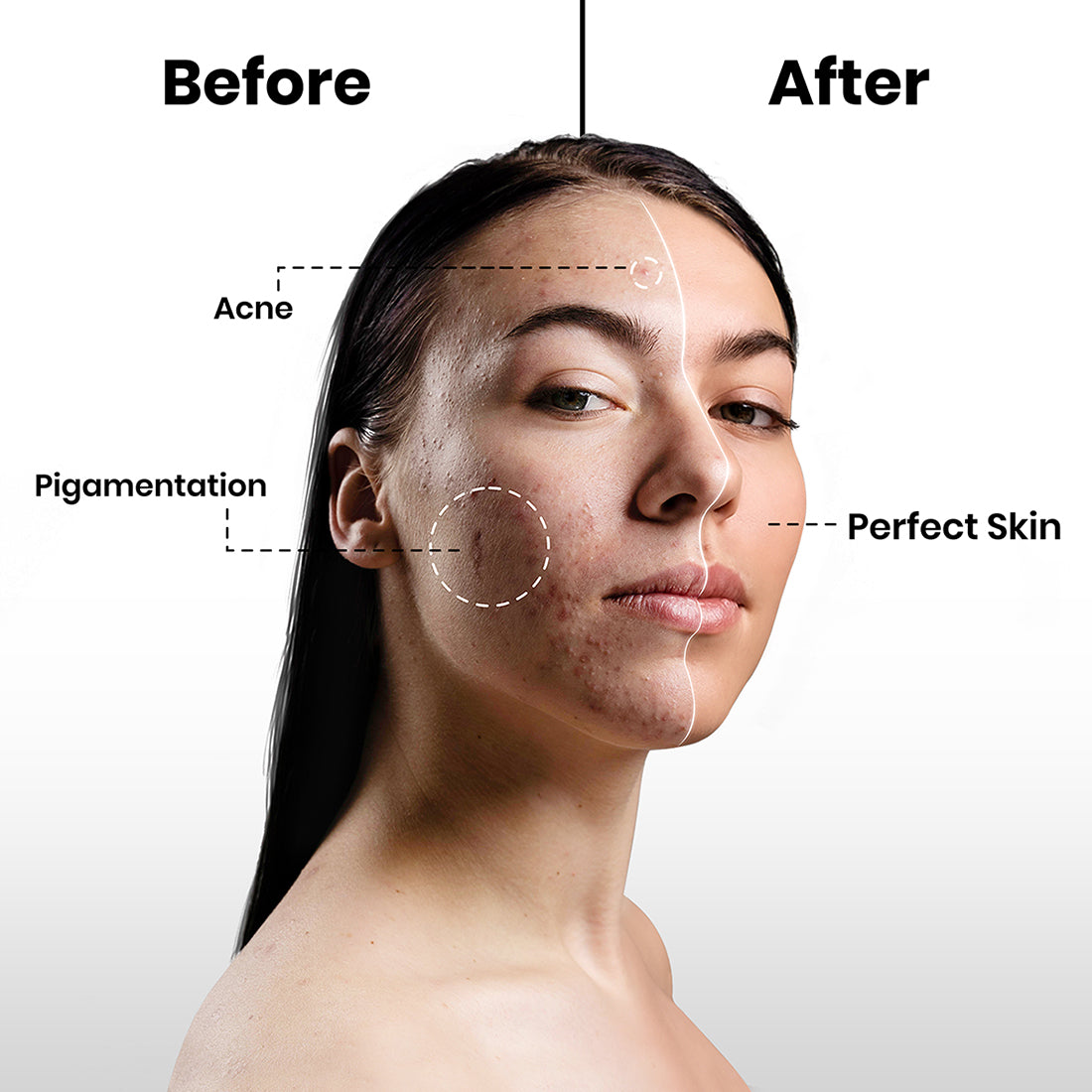 Glowmorous 10% Niacinamide Face Serum for Dark Spot Corrector